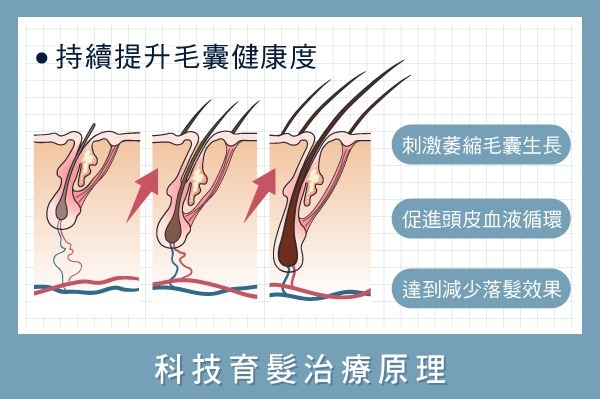 科技育髮-科技育髮治療原理-H&H醫髮診所