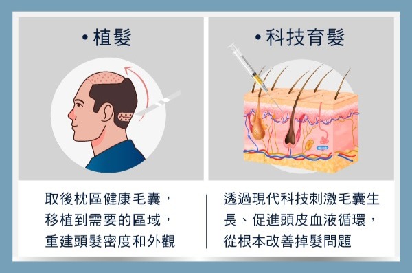 科技育髮-為什麼禿頭不一定要植髮？-H&H醫髮診所