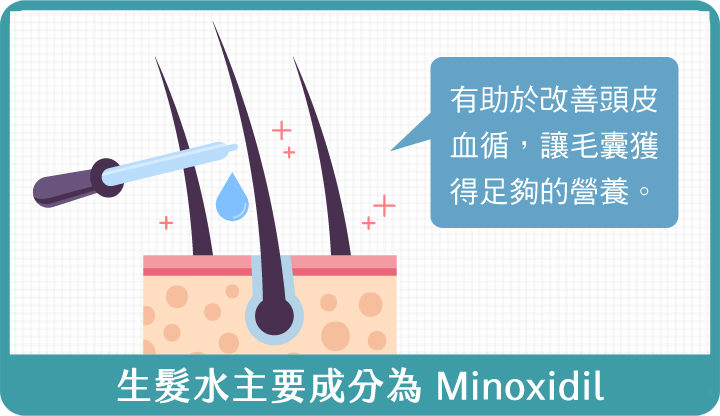 生髮水-生髮水主要成分為Minoxidil-HH醫髮診所