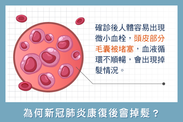 新冠肺炎掉髮-確診新冠肺炎後，容易因血栓導致毛囊被堵塞-HH醫髮診所