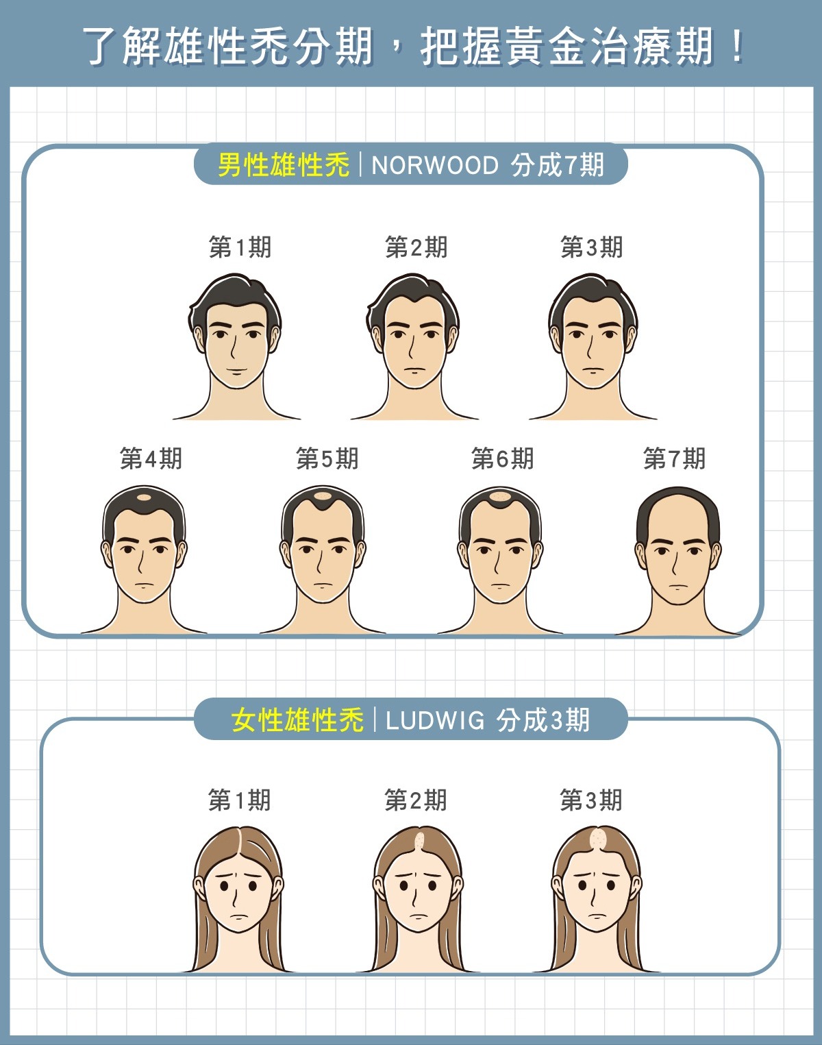 雄性禿-了解雄性禿分期，把握黃金治療期-HH醫髮診所